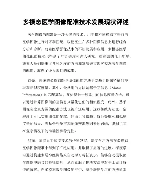 多模态医学图像配准技术发展现状评述