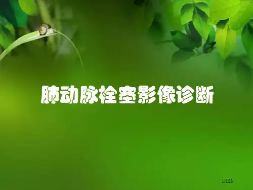 肺动脉栓塞影像诊断PPT幻灯片课件