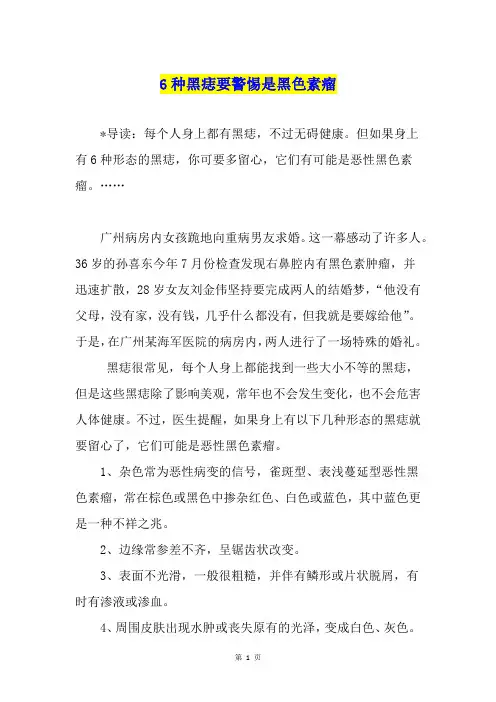 6种黑痣要警惕是黑色素瘤