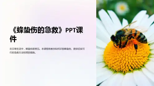 《蜂蛰伤的急救》课件