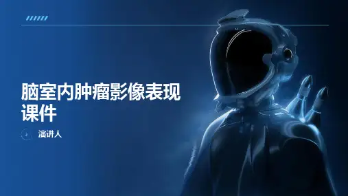脑室内肿瘤影像表现课件