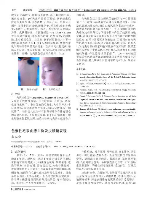色素性毛表皮痣1例及皮肤镜表现