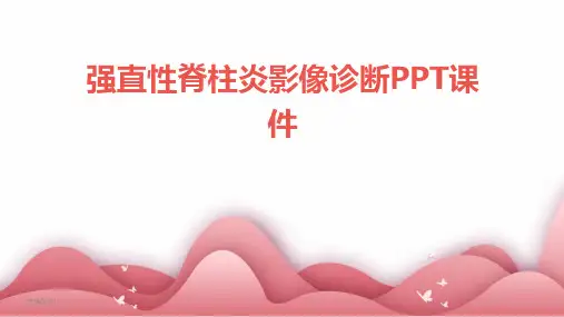 强直性脊柱炎影像诊断PPT课件