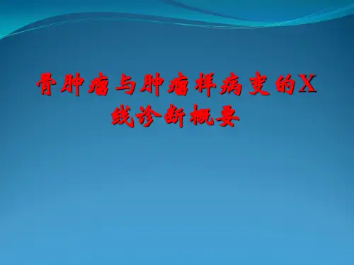 骨肿瘤与肿瘤样病变X线诊断概要