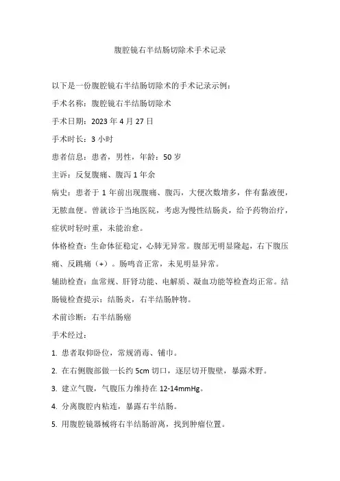腹腔镜右半结肠切除术手术记录