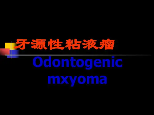 牙源性粘液瘤