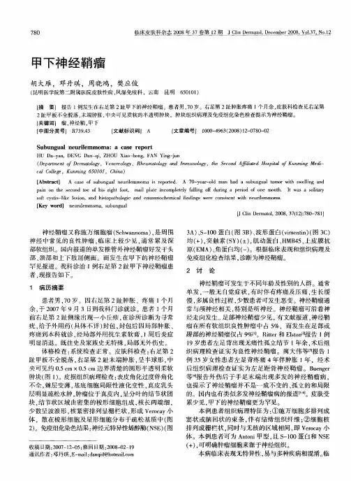 甲下神经鞘瘤