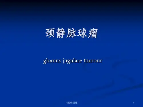 颈静脉球瘤PPT课件