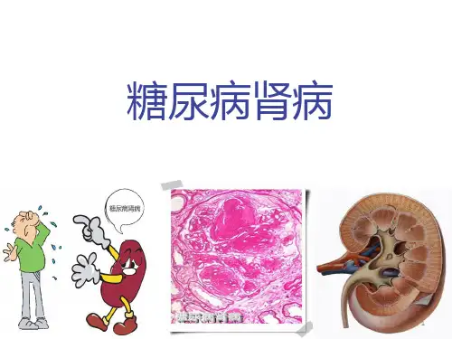 糖尿病肾病ppt课件