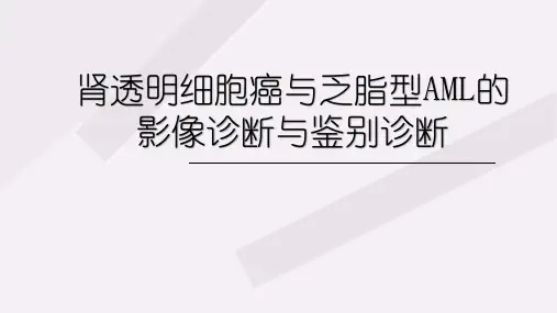 肾透明细胞癌与乏脂型AML的影像诊断与鉴别诊断