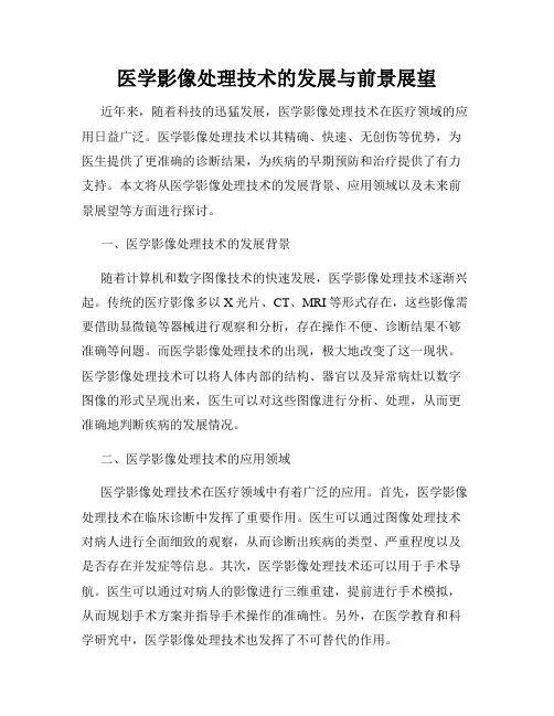 医学影像处理技术的发展与前景展望