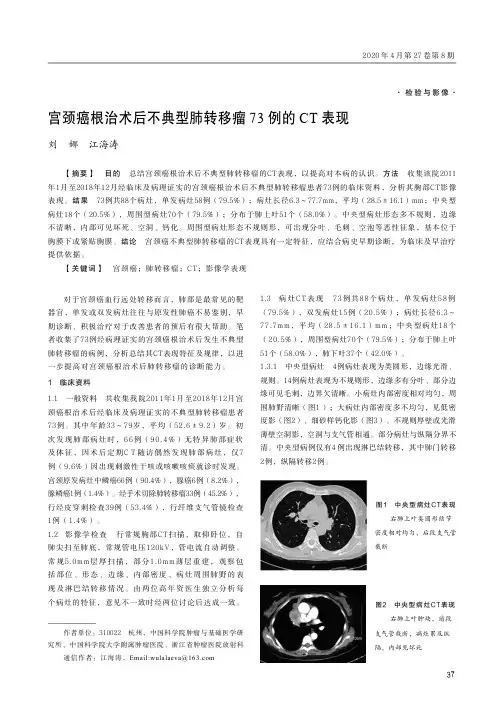 宫颈癌根治术后不典型肺转移瘤73例的CT表现