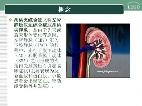 胡桃夹综合征