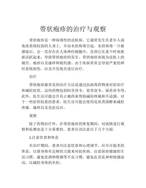 带状疱疹的治疗与观察