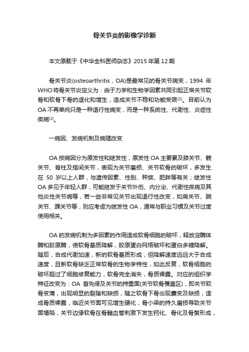 骨关节炎的影像学诊断