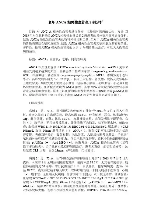 老年ANCA相关性血管炎2例分析