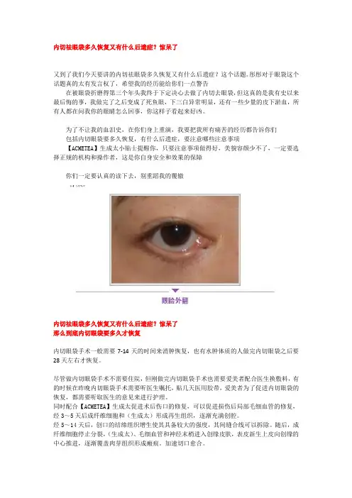 内切祛眼袋多久恢复又有什么后遗症？惊呆了
