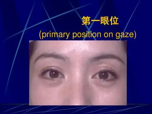 斜视和弱视眼科学-PPT课件