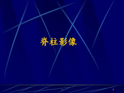 脊柱与脊髓病变的影像学检查方法与临床应用PPT课件