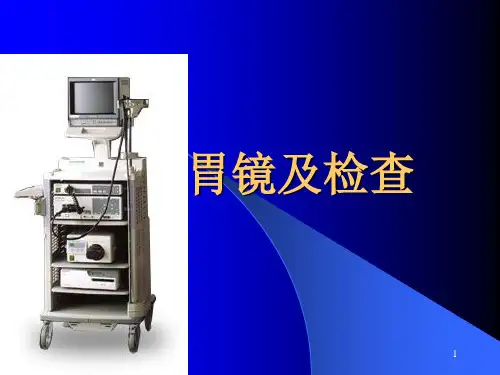 胃镜及检查PPT课件
