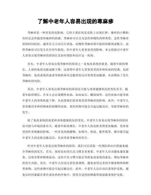 了解中老年人容易出现的荨麻疹