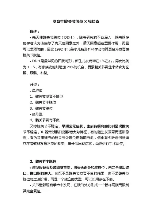 发育性髋关节脱位X线检查