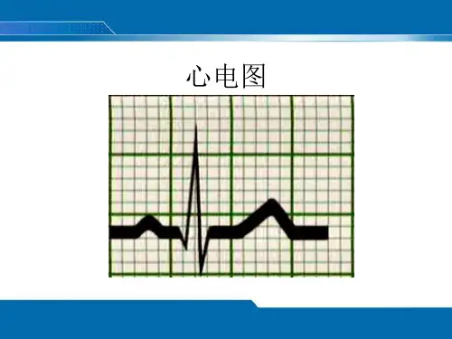 正常ECG(修)PPT课件