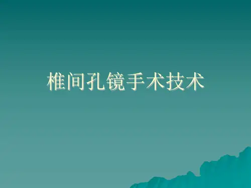 椎间孔镜 (1)