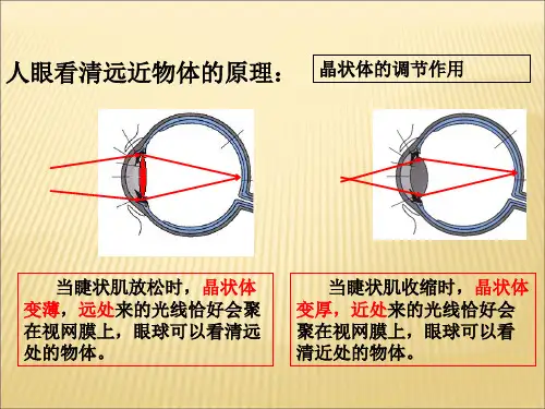 近视眼与远视眼的成因及矫正