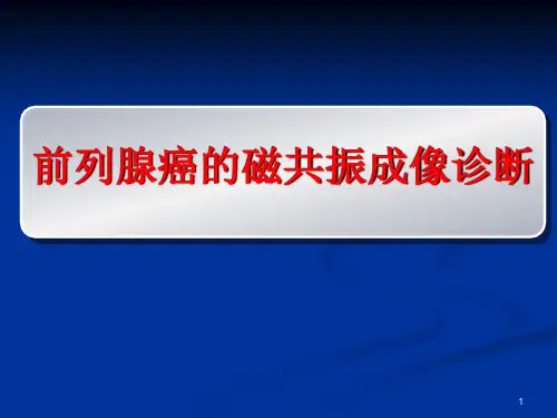 磁共振前列腺癌诊断标准