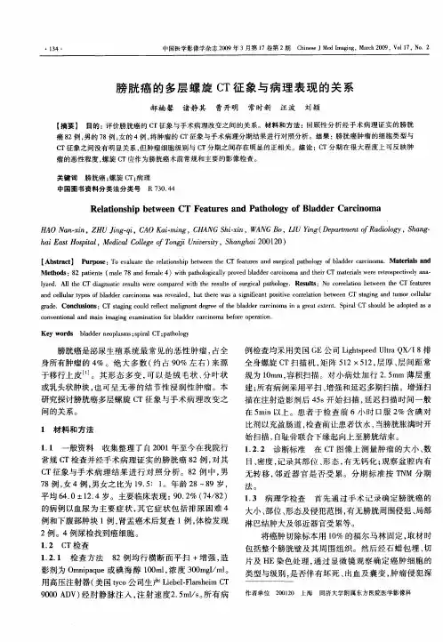 膀胱癌的多层螺旋CT征象与病理表现的关系