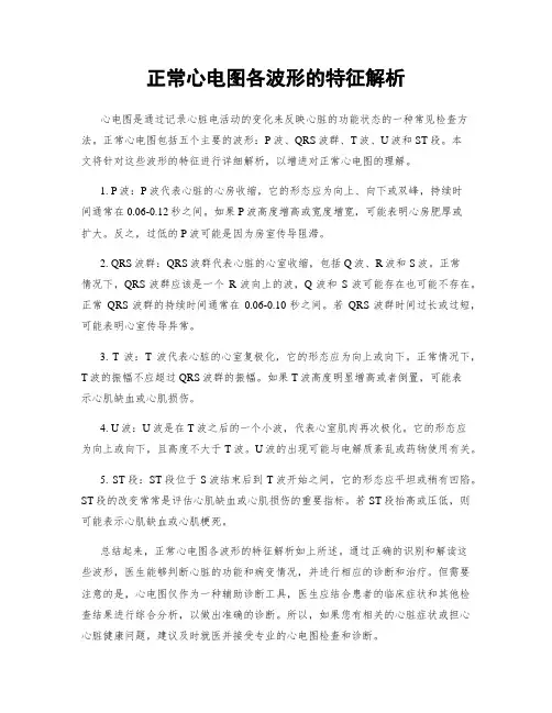 正常心电图各波形的特征解析