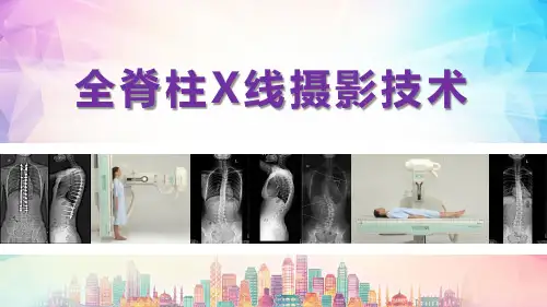 全脊柱x线摄影技术