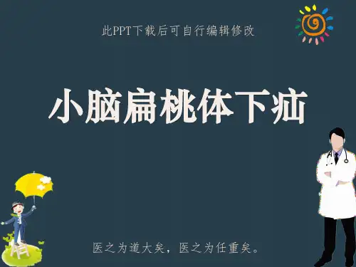 小脑扁桃体下疝PPT课件