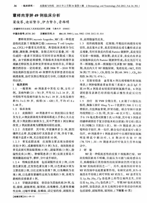 蕈样肉芽肿49例临床分析