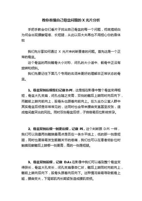 教你看懂自己骨盆问题的X光片分析