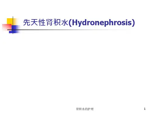 肾积水的护理-课件