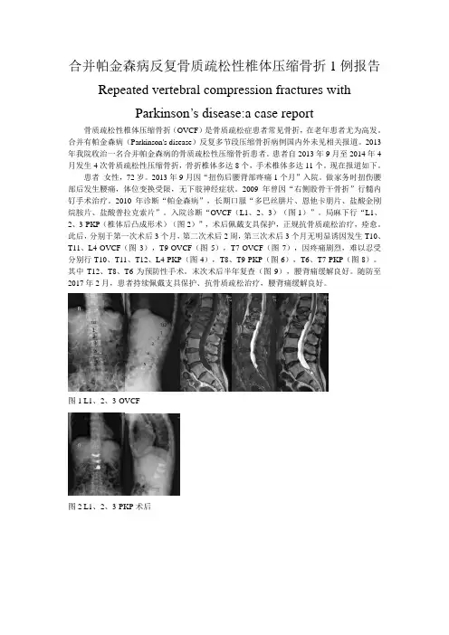 合并帕金森病反复椎体压缩骨折病例报告1例