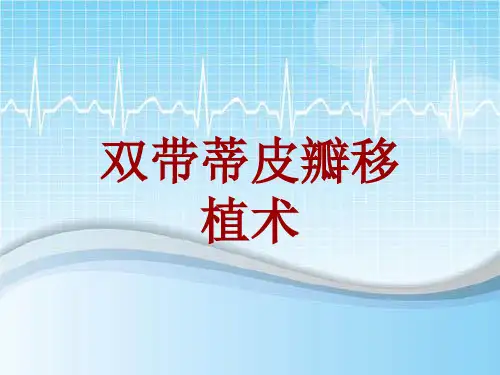 手术讲解模板：双带蒂皮瓣移植术