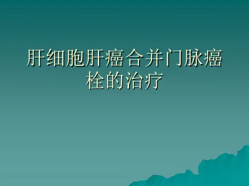 肝细胞肝癌合并门脉癌栓的治疗讲稿