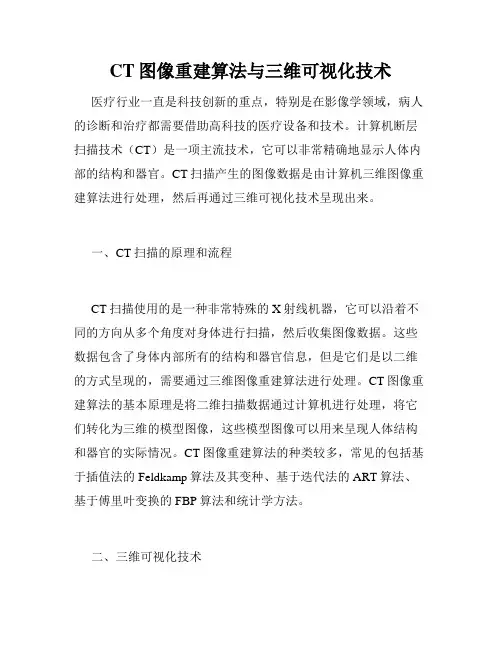 CT图像重建算法与三维可视化技术
