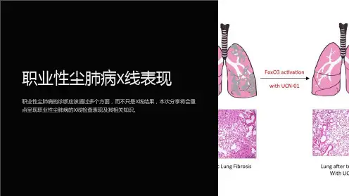 职业性尘肺病X线表现