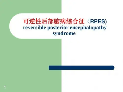 可逆性后部脑病综合征ppt课件