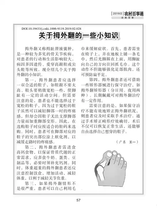 关于拇外翻的一些小知识
