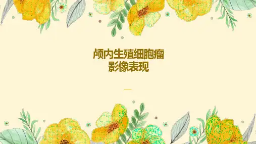 颅内生殖细胞瘤影像表现