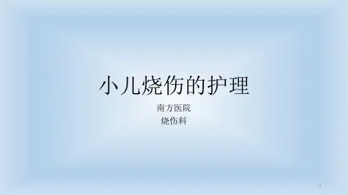小儿烧伤的护理ppt课件