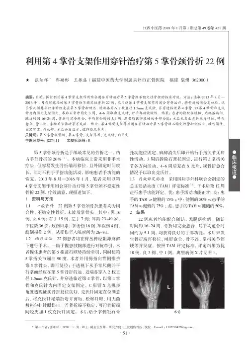 利用第4掌骨支架作用穿针治疗第5掌骨颈骨折22例