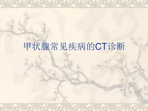 甲状腺常见疾病CT诊断