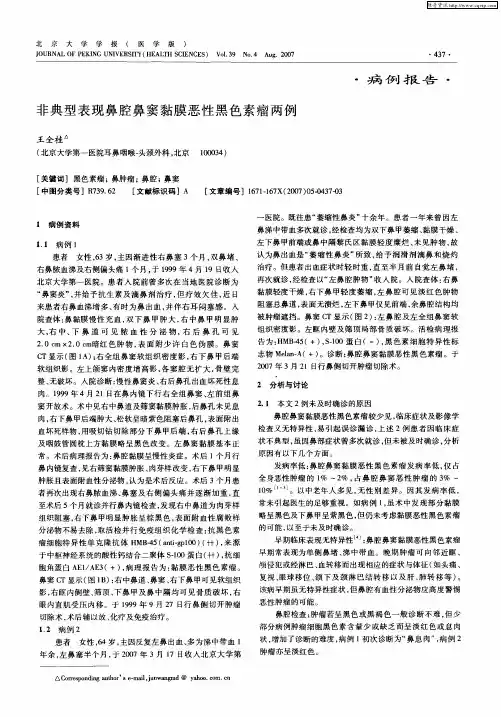 非典型表现鼻腔鼻窦黏膜恶性黑色素瘤两例