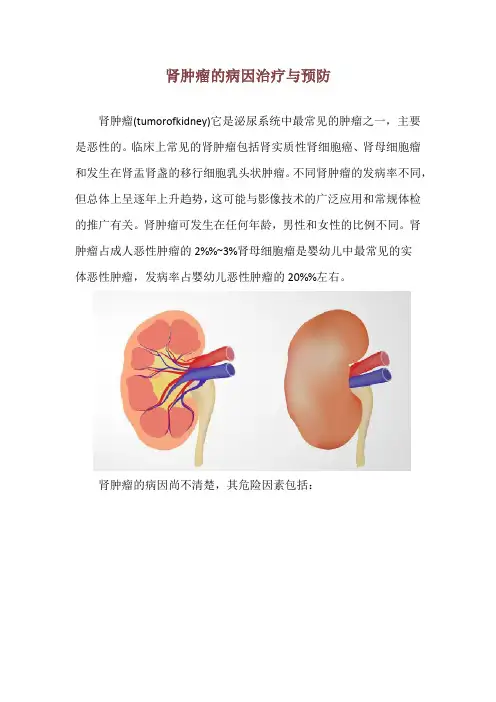 肾肿瘤的病因治疗与预防